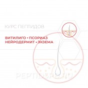 Витилиго,псориаз, нейродермит, экзема